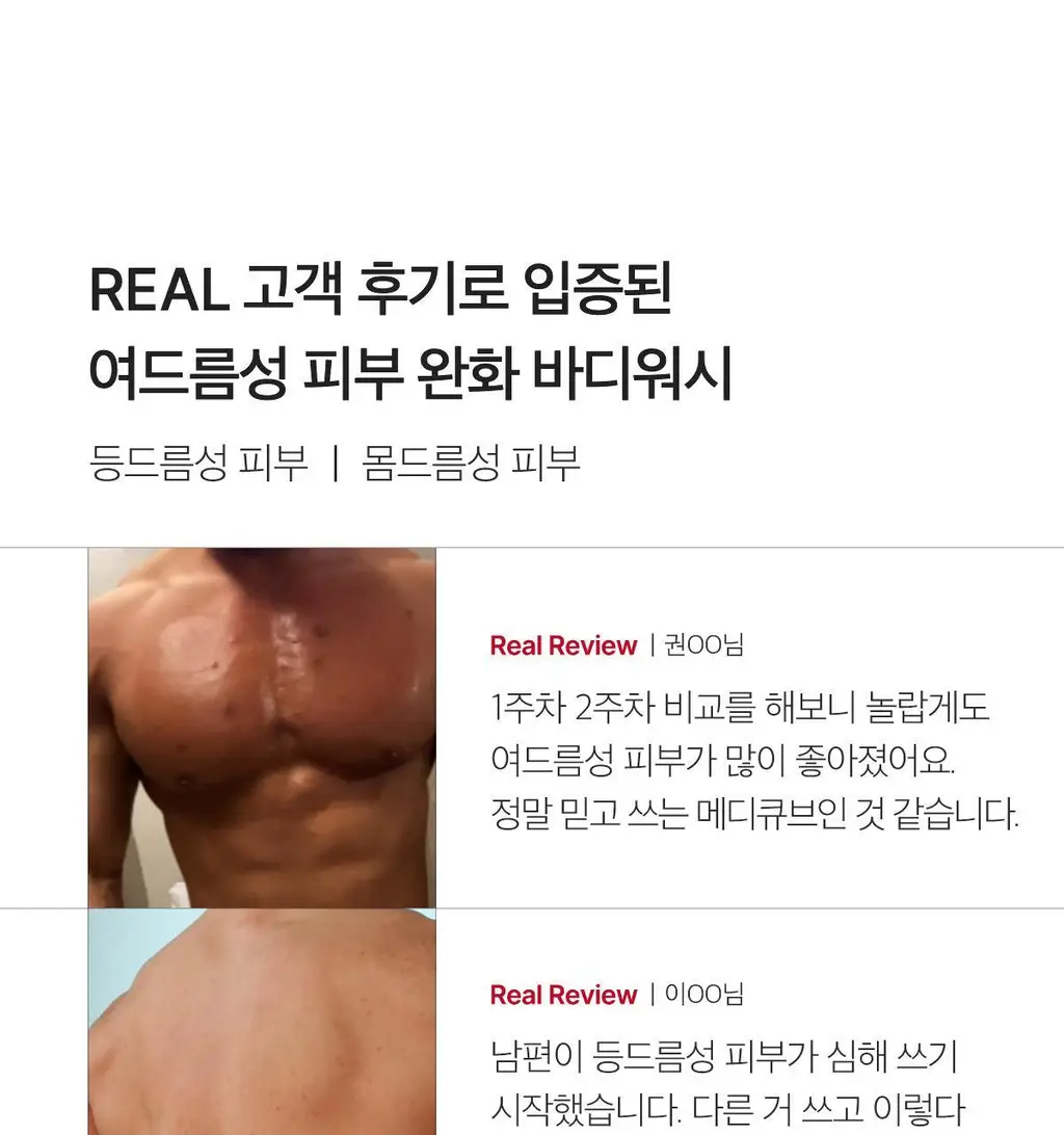 [등드름 바디워시] 메디큐브 레드 아크네 바디워시 400g 상세페이지 8